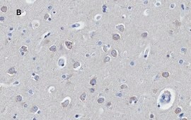 Anti-Huntingtin Protein Antibody, clone 1M11, ZooMAb&#174; Rabbit Monoclonal recombinant, expressed in HEK 293 cells