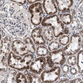 Anti-NKTR antibody produced in rabbit Prestige Antibodies&#174; Powered by Atlas Antibodies, affinity isolated antibody, buffered aqueous glycerol solution