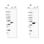 Anti-ACAT1 antibody produced in rabbit Ab1, Prestige Antibodies&#174; Powered by Atlas Antibodies, affinity isolated antibody, buffered aqueous glycerol solution