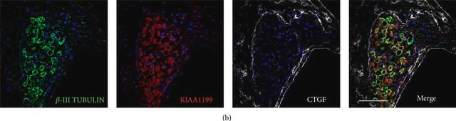 Monoclonal Anti-β-Tubulin III antibody produced in mouse clone SDL.3D10, ascites fluid