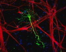 Human Cortical Astrocytes Human iPSC line, Fully differentiated, Healthy Male Control (no known neurological disorders), Cryopreserved