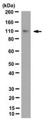 Anti-Progesterone Receptor B Antibody, clone 250/H11 clone 250/H11, from mouse