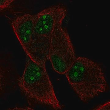 Anti-Tceal9 Antibody Produced In Rabbit Prestige Antibodies® Powered by Atlas Antibodies, affinity isolated antibody, buffered aqueous glycerol solution