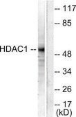Anti-HDAC1 antibody produced in rabbit affinity isolated antibody