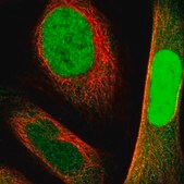 Anti-NANS antibody produced in rabbit Prestige Antibodies&#174; Powered by Atlas Antibodies, affinity isolated antibody, buffered aqueous glycerol solution