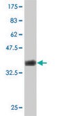 ANTI-LBX1 antibody produced in mouse clone 2F8, purified immunoglobulin, buffered aqueous solution