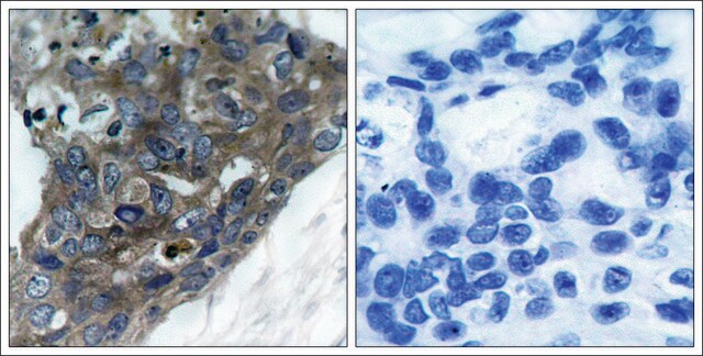 Anti-MAP3K5 (Ab-966) antibody produced in rabbit affinity isolated antibody