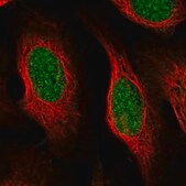 Anti-CCDC175 antibody produced in rabbit Prestige Antibodies® Powered by Atlas Antibodies, affinity isolated antibody, buffered aqueous glycerol solution