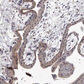 Anti-GAPVD1 antibody produced in rabbit Prestige Antibodies® Powered by Atlas Antibodies, affinity isolated antibody, buffered aqueous glycerol solution, ab2