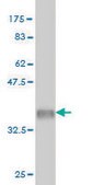 Monoclonal Anti-EIF5A2 antibody produced in mouse clone 1E7, purified immunoglobulin, buffered aqueous solution