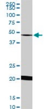 Monoclonal Anti-NADK antibody produced in mouse clone 5F4, purified immunoglobulin, buffered aqueous solution