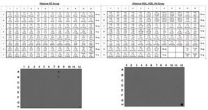 Anti-dimethyl-Histone H3 (Lys4) Antibody, clone AW30, Trial Size culture supernatant, clone AW30, Upstate®