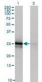 Monoclonal Anti-FGF21 antibody produced in mouse clone 3G10, purified immunoglobulin, buffered aqueous solution