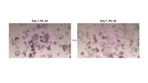 3dGRO® Human Liver Organoids (MNFBQ01LI (63-65)) Normal, Liver, Age: 60, Male, Mutation: None