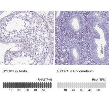 Anti-SYCP1 antibody produced in rabbit Prestige Antibodies&#174; Powered by Atlas Antibodies, affinity isolated antibody, buffered aqueous glycerol solution