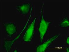 Monoclonal Anti-C6ORF199, (C-terminal) antibody produced in mouse clone 1H8, purified immunoglobulin, buffered aqueous solution