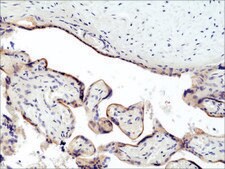 Anti-CD71 antibody, Rabbit monoclonal recombinant, expressed in HEK 293 cells, clone RM384, purified immunoglobulin
