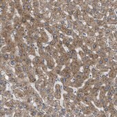 Anti-SSR1 antibody produced in rabbit Prestige Antibodies&#174; Powered by Atlas Antibodies, affinity isolated antibody, buffered aqueous glycerol solution