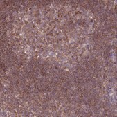 抗-PRKAR1A 兔抗 Prestige Antibodies&#174; Powered by Atlas Antibodies, affinity isolated antibody, buffered aqueous glycerol solution