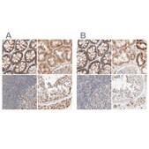 Anti-MRM3 antibody produced in rabbit Prestige Antibodies® Powered by Atlas Antibodies, affinity isolated antibody, buffered aqueous glycerol solution, Ab2