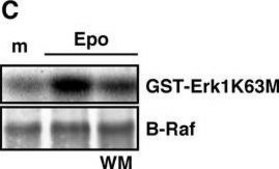Anti-B-Raf Antibody Upstate®, from rabbit