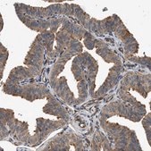 Anti-DUSP14 antibody produced in rabbit Prestige Antibodies&#174; Powered by Atlas Antibodies, affinity isolated antibody, buffered aqueous glycerol solution
