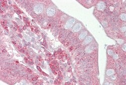 Anti-PSEN1 antibody produced in rabbit affinity isolated antibody