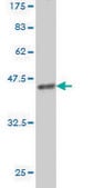 Monoclonal Anti-MS4A1 antibody produced in mouse clone 5C11, purified immunoglobulin, buffered aqueous solution