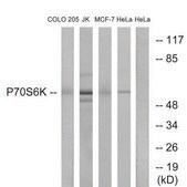 Anti-p70 S6 Kinase antibody produced in rabbit affinity isolated antibody
