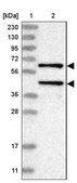 Anti-PPM1A antibody produced in rabbit Prestige Antibodies&#174; Powered by Atlas Antibodies, affinity isolated antibody, buffered aqueous glycerol solution