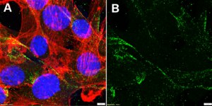 Anti-RYR1 Antibody, clone 1K4 ZooMAb® Rabbit Monoclonal recombinant, expressed in HEK 293 cells
