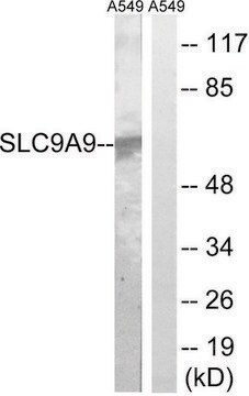 Anti-SLC9A9 antibody produced in rabbit affinity isolated antibody
