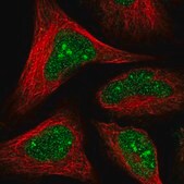 Anti-HDDC2 antibody produced in rabbit Prestige Antibodies&#174; Powered by Atlas Antibodies, affinity isolated antibody, buffered aqueous glycerol solution