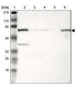Anti-METTL3 antibody produced in rabbit Prestige Antibodies® Powered by Atlas Antibodies, affinity isolated antibody, buffered aqueous glycerol solution