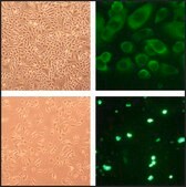 Human Tracheal Epithelial Cells: HTEpC, adult