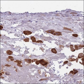 Anti-COL27A1 antibody produced in rabbit Prestige Antibodies&#174; Powered by Atlas Antibodies, affinity isolated antibody, buffered aqueous glycerol solution