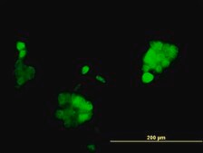 Monoclonal Anti-PGR, (N-terminal) antibody produced in mouse clone 2C2, purified immunoglobulin, buffered aqueous solution