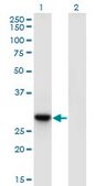 Monoclonal Anti-RBJ antibody produced in mouse clone 3C1, purified immunoglobulin, buffered aqueous solution