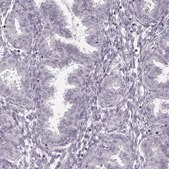 Anti-SPA17 antibody produced in rabbit Prestige Antibodies&#174; Powered by Atlas Antibodies, affinity isolated antibody, buffered aqueous glycerol solution
