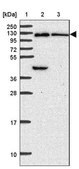 Anti-OSBPL7 antibody produced in rabbit Prestige Antibodies&#174; Powered by Atlas Antibodies, affinity isolated antibody, buffered aqueous glycerol solution