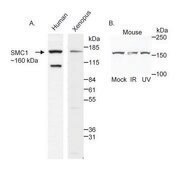 Rabbit anti-SMC1 Antibody, Affinity Purified