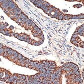 Anti-BCL2L14/BCLG antibody produced in rabbit
