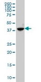 Monoclonal Anti-ABHD5 antibody produced in mouse clone 4B12, purified immunoglobulin, buffered aqueous solution