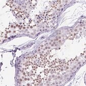 Anti-MARCH10 antibody produced in rabbit Prestige Antibodies&#174; Powered by Atlas Antibodies, affinity isolated antibody, buffered aqueous glycerol solution, Ab2