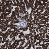 Anti-ACADS antibody produced in rabbit Prestige Antibodies&#174; Powered by Atlas Antibodies, affinity isolated antibody, buffered aqueous glycerol solution, Ab2