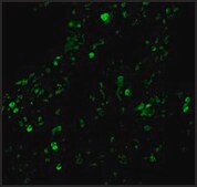 Anti-cIAP antibody produced in rabbit affinity isolated antibody, buffered aqueous solution