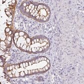 Anti-ANKRD29 antibody produced in rabbit Prestige Antibodies&#174; Powered by Atlas Antibodies, affinity isolated antibody, buffered aqueous glycerol solution