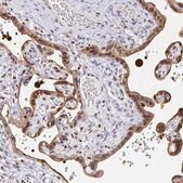 Anti-CLIC3 antibody produced in rabbit Prestige Antibodies® Powered by Atlas Antibodies, affinity isolated antibody, buffered aqueous glycerol solution