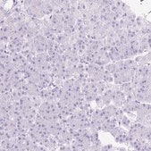 Anti-SLC8A2 antibody produced in rabbit Prestige Antibodies&#174; Powered by Atlas Antibodies, affinity isolated antibody, buffered aqueous glycerol solution