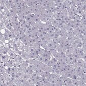 Anti-TMC3 antibody produced in rabbit Prestige Antibodies&#174; Powered by Atlas Antibodies, affinity isolated antibody, buffered aqueous glycerol solution
